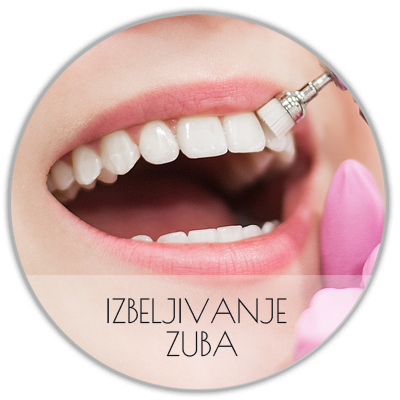 izbeljivanje-zuba Izbeljivanje zuba Beograd