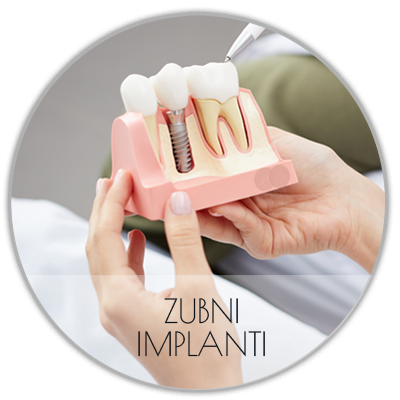zubni-implanti Zubni implanti Beograd